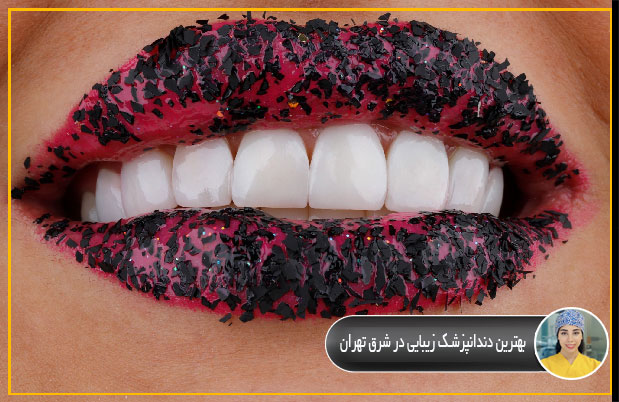 بهترين دندانپزشك زيبايي در شرق تهران