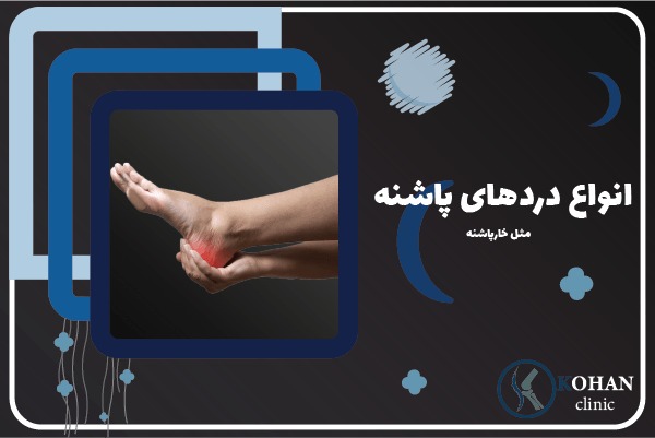 کلینیک درمان خارپاشنه و درد پاشنه در غرب تهران