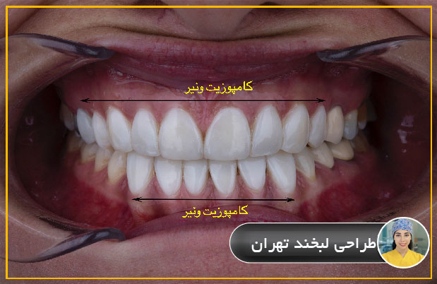 طراحی لبخند تهران