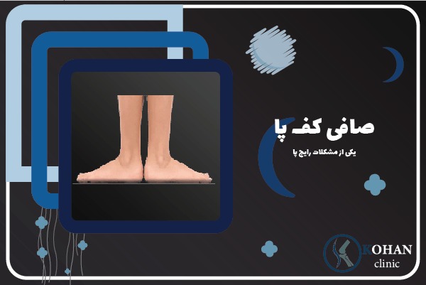 کلینیک تخصصی صافی کف پا در منطقه دو ۲ تهران - کلینیک سلامت پا کهن
