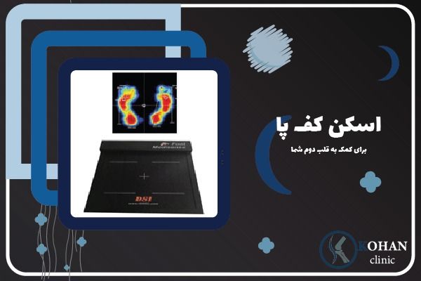 بهترین اسکن کف پا کفی طبی و درمان خارپاشنه در منطقه پنج منطقه 5 تهران