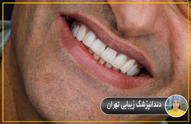 دندانپزشک زیبایی تهران